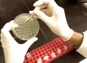 Colony PCR